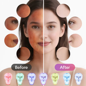 7-Color LED Face & Neck Mask | Anti-Aging Light Therapy Device