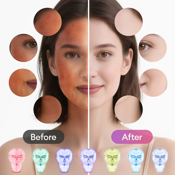 7-Color LED Face & Neck Mask | Anti-Aging Light Therapy Device